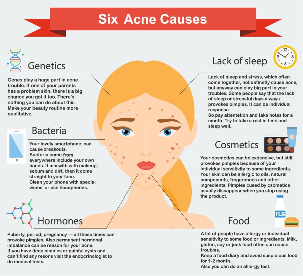 How To Treat Acne E Skin D Souza
